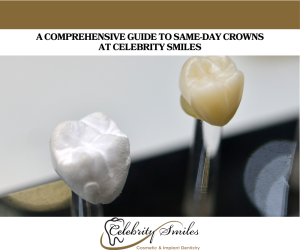 A Comprehensive Guide to Same-Day Crowns at Celebrity Smiles