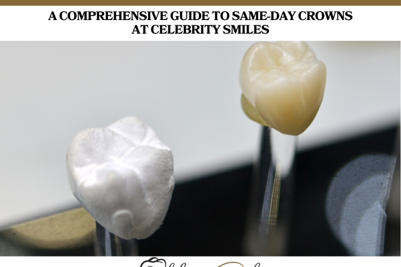 A Comprehensive Guide to Same-Day Crowns at Celebrity Smiles
