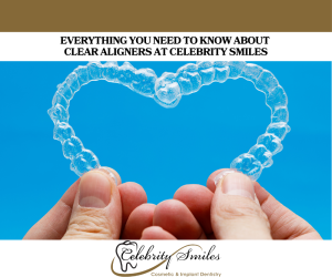 Everything You Need to Know About Clear Aligners at Celebrity Smiles