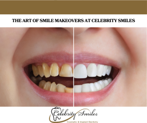 The Art of Smile Makeovers at Celebrity Smiles
