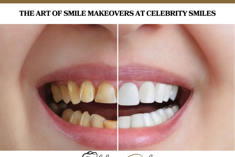 The Art of Smile Makeovers at Celebrity Smiles