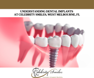 Understanding Dental Implants at Celebrity Smiles, West Melbourne, FL