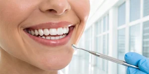 A woman's perfect smile, showing the natural-looking result of dental veneers.