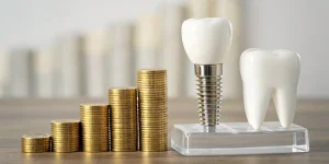Dental implant and tooth model with gold coins showing how much dental implants cost.